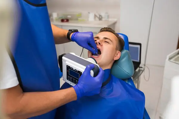 Todo sobre el Sonic Scaler Dental
