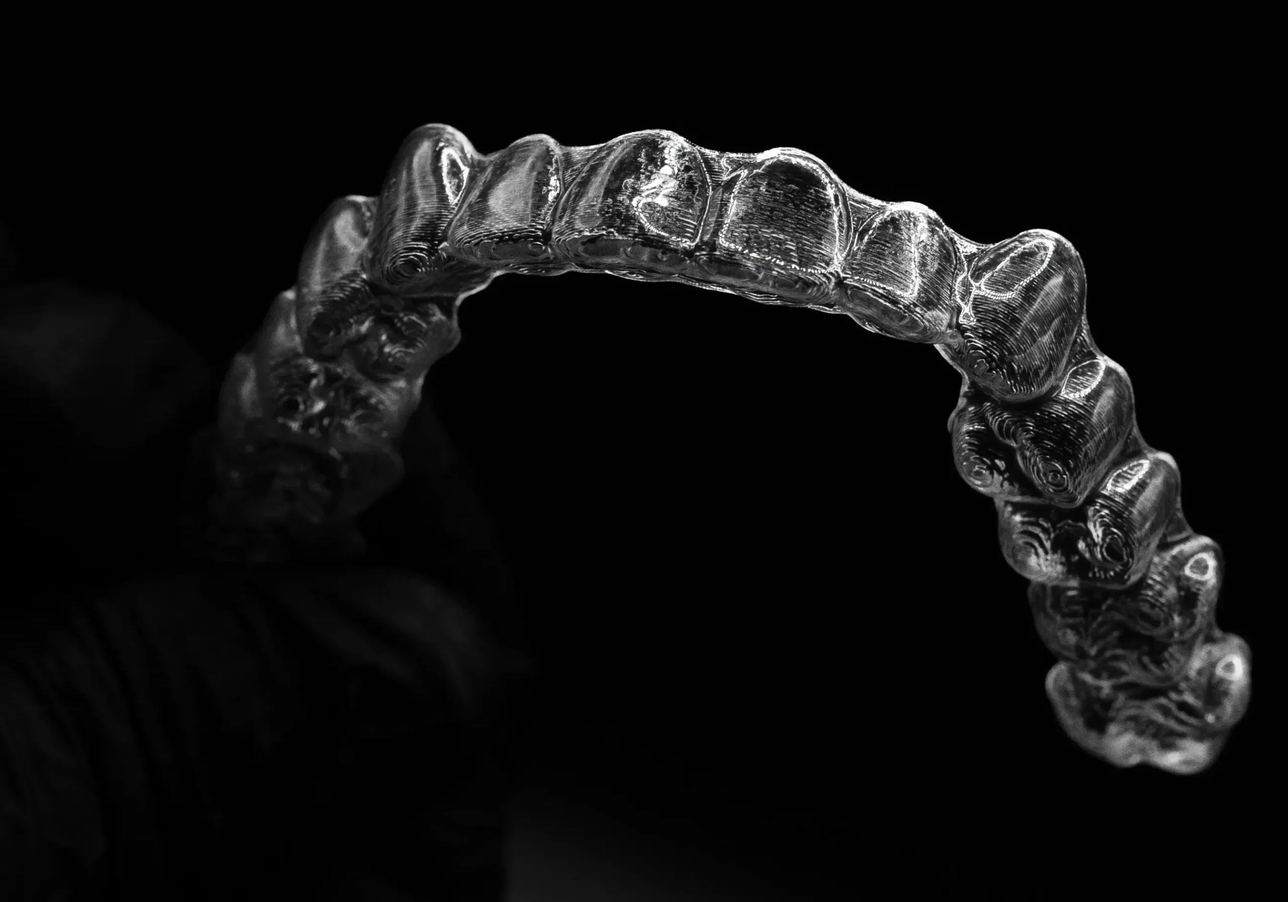 Invisalign Madrid