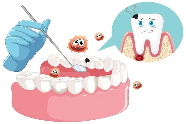 Correcta limpeza dental