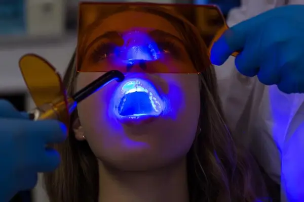 Por qué elegir el blanqueamiento dental por fotoactivación