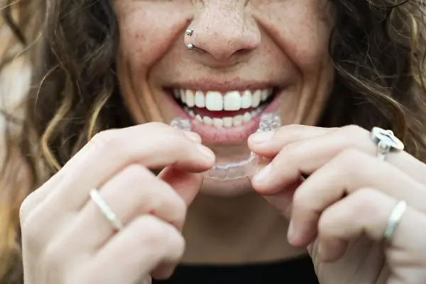 Por qué se separan los dientes Causas y soluciones