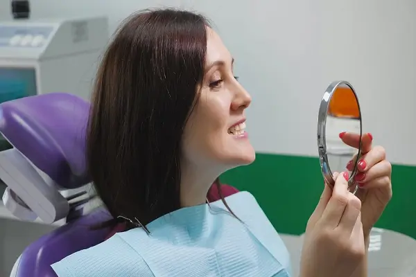 Qué son las Carillas y cómo pueden ayudar en la Periodontitis