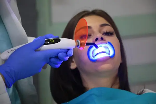 Todo lo que necesitas saber sobre el blanqueamiento dental por fotoactivación