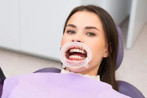 un problema dental poco conocido